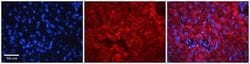 ERCC8 Rabbit anti-Human, Polyclonal, Novus Biologicals:Antibodies:Primary